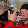 Photographing the nasal mucosa at EBC